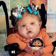 Adeline Grace Moyer, smiling, with two blue bows in her hair